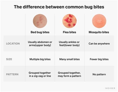 How To Identify And Treat Bed Bug Bites Business Insider