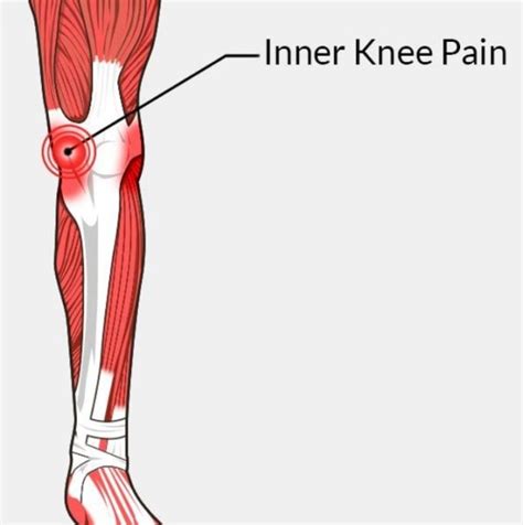 Interior Knee Pain Causes Awesome Home