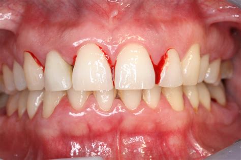 Simple Science: How to Make a Volcano with Kids