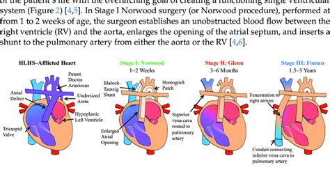 Overview Of The Characteristics Of Hypoplastic Left Heart Syndrome