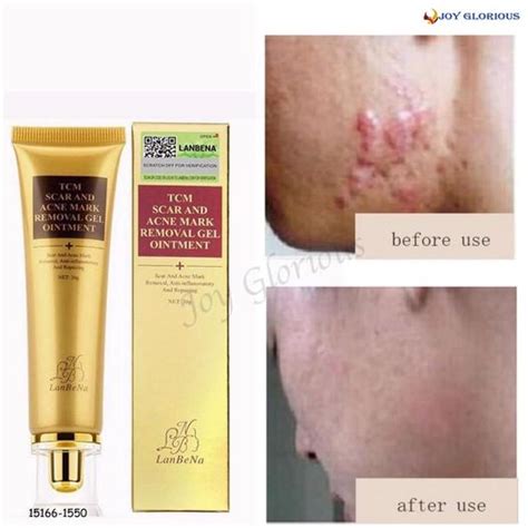 Tcm Scar And Acne Mark Removal Gel Ointment Cream 100 Original 30g