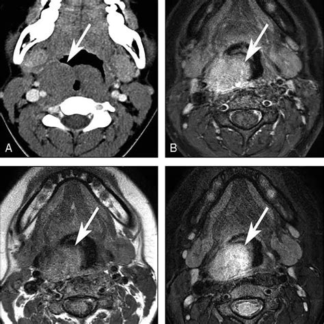 Computed Tomography Ct And Conventional Magnetic Resonance Imaging