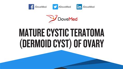 Mature Cystic Teratoma Dermoid Cyst Of Ovary