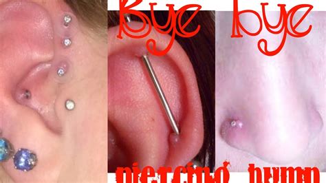 How To Get Rid Of A Piercing Bump Youtube
