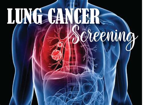 Lung Cancer Screening Roosevelt Ut Uintah Basin Medical Center