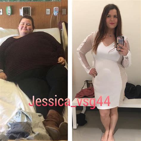 Morbidly Obese Woman Sheds 14st To Become Instagram Star Look At Her