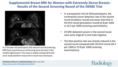Supplemental Breast Mri For Women With Extremely Dense Breasts Results