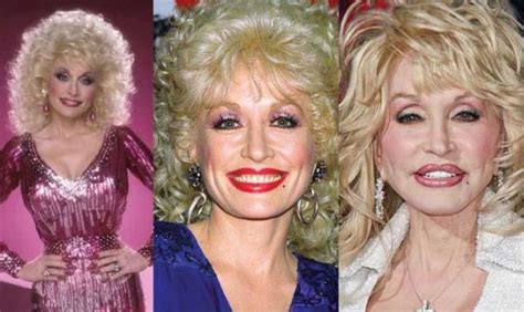 Dolly Parton Plastic Surgery Before And After Pictures