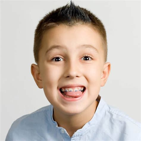 Aligned Orthodontics Salford Orthodontics Nhs Treatment