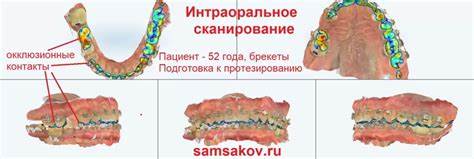 Диета при удалении матки