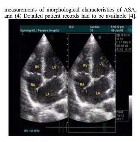 The Diagnostic Value Of Two Echocardiography Methods For Atrial Septal