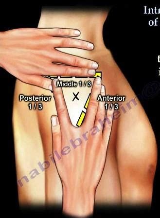 Injections sites Flashcards | Easy Notecards