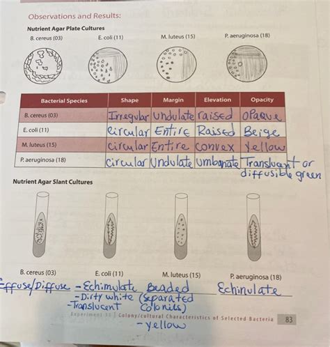 選択した画像 Li Morphology On Agar Plate 133866 How To Identify E Coli On