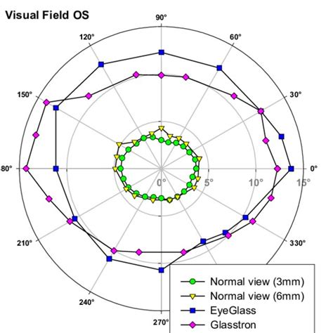 Visual Field Of A Rp Patient With Normal View And Augmented Vision