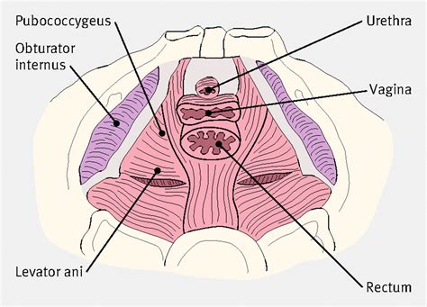 diagnosing and managing vaginismus the bmj