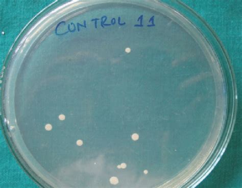 Smooth Creamy While Colonies Of Candida Growing On Sabourauds Dextrose
