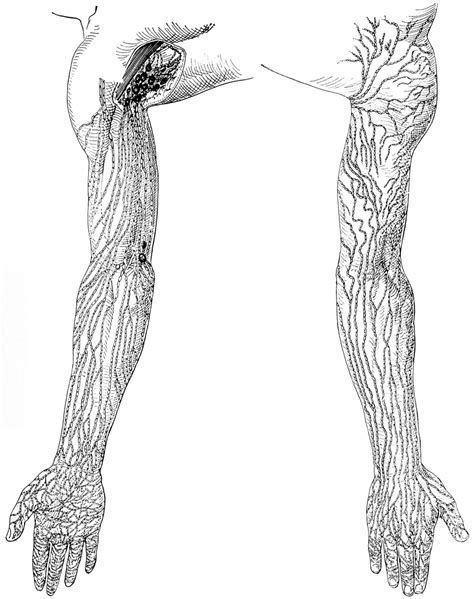 Lymphatic Vessels And Nodes Of The Arms Clipart Etc