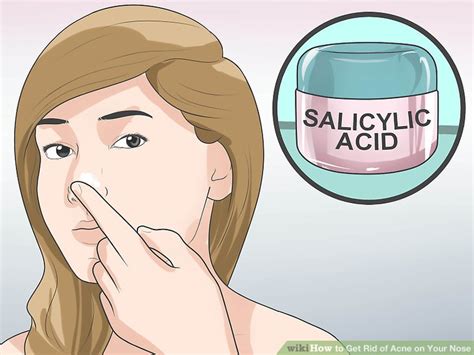 4 Ways To Get Rid Of Acne On Your Nose Wikihow