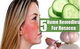 Images of Home Remedies For Rosacea Pimples