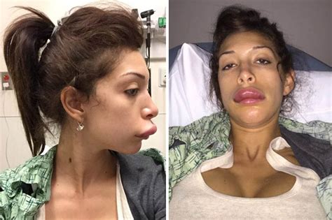 The Most Shocking Celebrity Plastic Surgery Failures