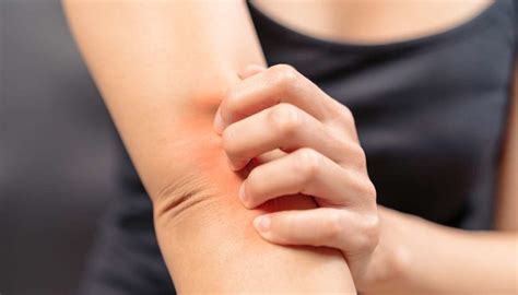 Menopause Itching Causes Types Home Remedies And Treatments
