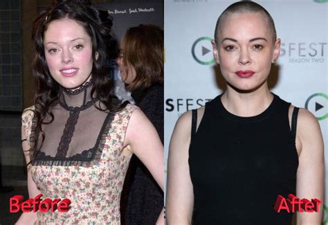 Rose Mcgowan Plastic Surgery Before And After Short News Poster