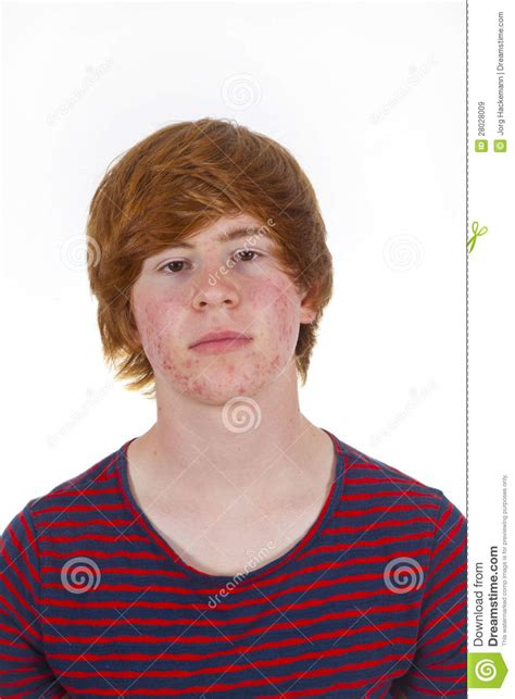 Aantrekkelijke Jongen In Puberteit Stock Afbeelding Image Of Gelukkig