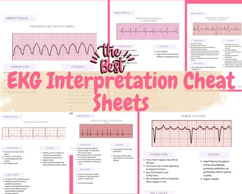 The Best Ekg Interpretation And Heart Arrhythmias Cheat Sheet Etsy