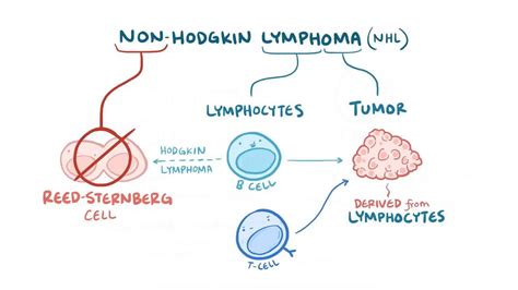 Non Hodgkin Lymphoma Video Anatomy And Definition Osmosis