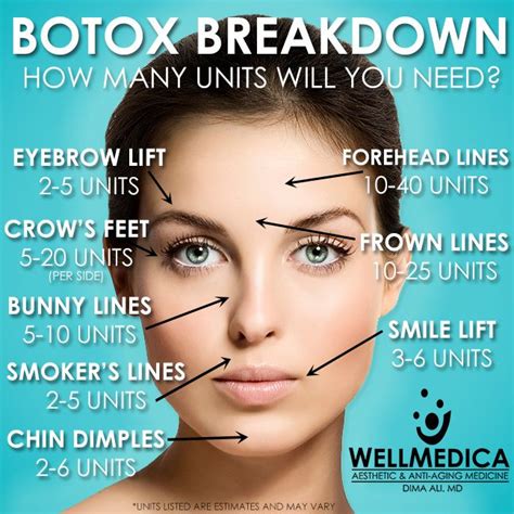 Use This Chart To Determine How Much Botox Is Needed For Each Facial