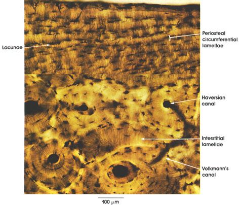 Sometimes referred to as 'spongy bone' or 'trabecular bone', cancellous bone is found within the middle of large bones. Plate 3.49: Bone