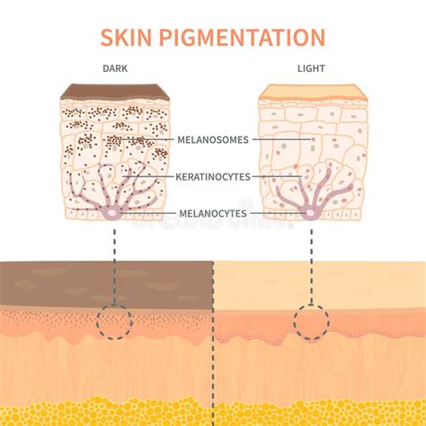Skin Tone Pigmentation Mechanism Infographic Medical Diagram Stock