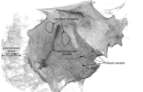 Several related medical conditions involve sebum—including acne, hyperplasia, and sebaceous adenoma. HLS [ Connective Tissue, spread areolar connective tissue ...