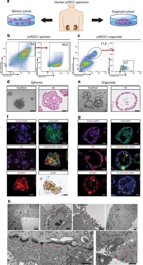 Characterization Of Ccrcc Derived Sphere And Organoid Cultures A Human