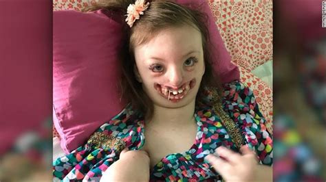 Mom Of Girl With Facial Deformity Fights Twitter Troll Who Used Her