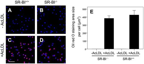 Knockout Of Sr Bi In Macrophages Does Not Affect Acldl Driven Foam Cell
