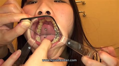 Compilation Tooth Mouth Bokeptube