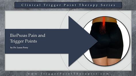 Iliopsoas Pain And Trigger Points Youtube