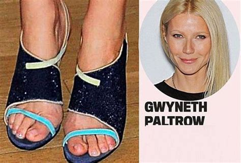 Celebrities With Ugly Feet Barnorama