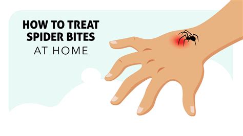 How To Prevent Spider Bites Proven Strategies For Keeping Spiders Away