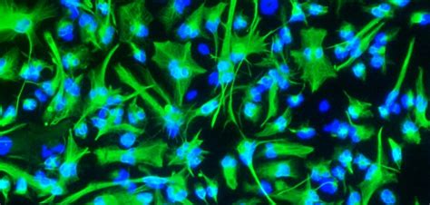 Turmeric compound boosts regeneration of brain stem cells