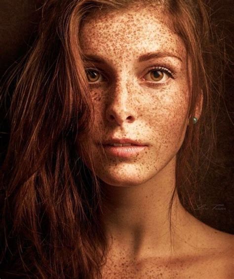 15 Freckled People Wholl Hypnotize You With Their Unique