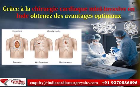 Gr Ce La Chirurgie Cardiaque Mini Invasive En Inde Obtenez Des Avantages Optimaux Surgery