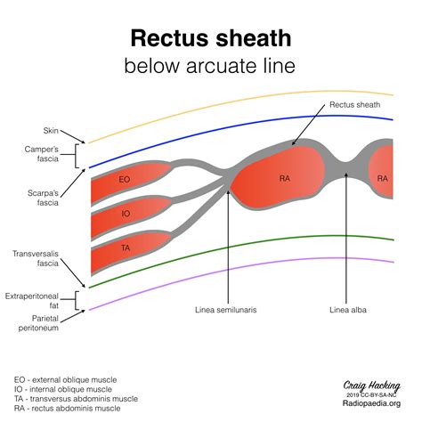 Rectus Sheath Diagram Image Radiopaedia Org