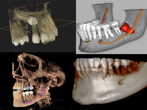 Cone Beam Computed Tomography 3d Cbct Phan Endodontic Partners