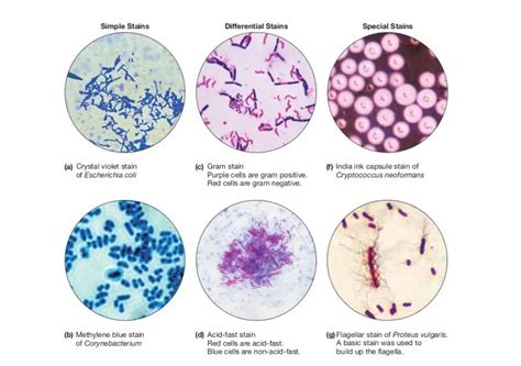 Types Of Staining Techniques Used In Microbiology • Microbe Online