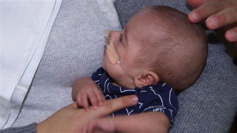 One Of The Smallest Most Premature Babies In The World Finally Goes
