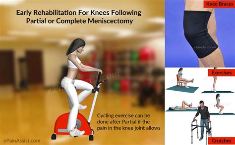 The thick, abnormal shape of a discoid meniscus makes it more likely to get stuck in the knee or tear. Knee Rehabilitation Following Meniscectomy, Meniscal ...