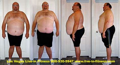 Maybe you would like to learn more about one of these? Morbid Obesity Weight Loss Camp at Debra's Live-in Retreat