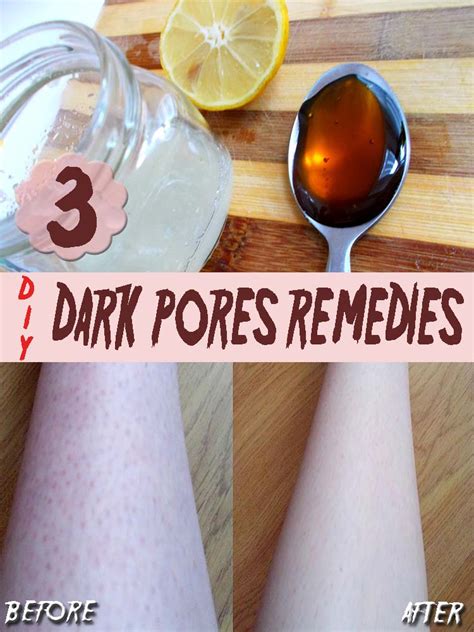 You may have just nicked with yes, sometimes: 3 Homemade Remedies for Dark Pores ! - HomeMadeLifeProject